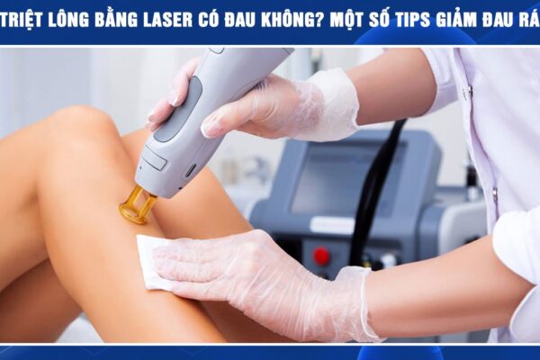 Triệt lông bằng công nghệ Diode laser ruby AI có đau không?